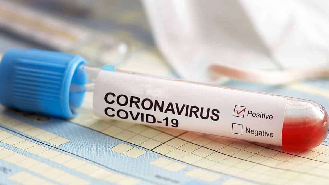 30 yıllık Türk devinde acı son: Pandemide dünyaya satıyorlardı, resmen iflas kararı verildi! 7